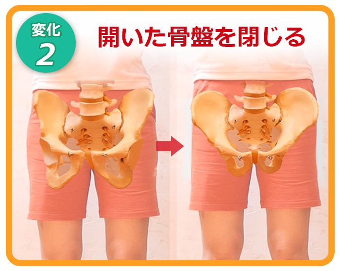 メディカル骨盤矯正法 セミナー スクール 東京 埼玉